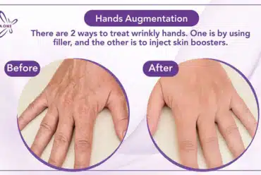 Hands Augmentation