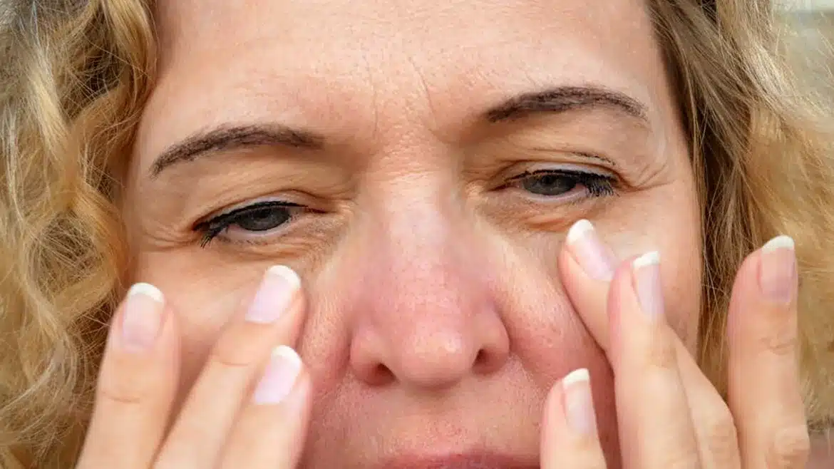 How to Prevent and Treat Wrinkles
