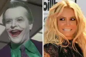 joker-smile botox