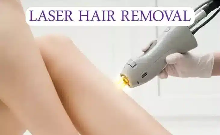 Laser Hair Removal: What You Need to Know?