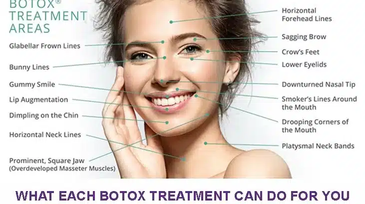 What Each Botox Treatment Can Do for You