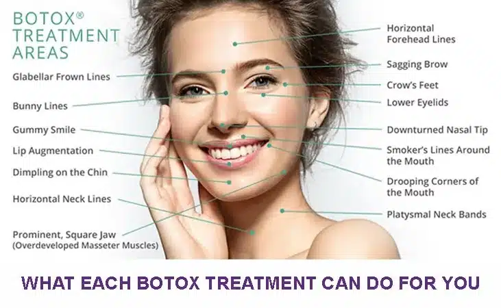 What Each Botox Treatment Can Do