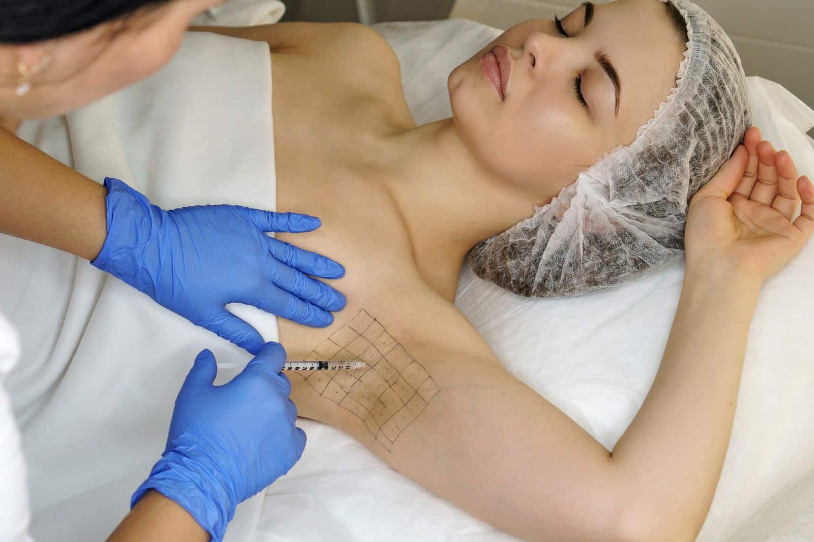 underarm botox procedure
