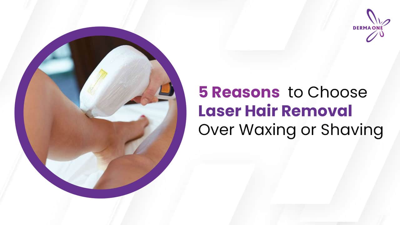 5 Reasons to Choose Laser Hair Removal Over Waxing or Shaving