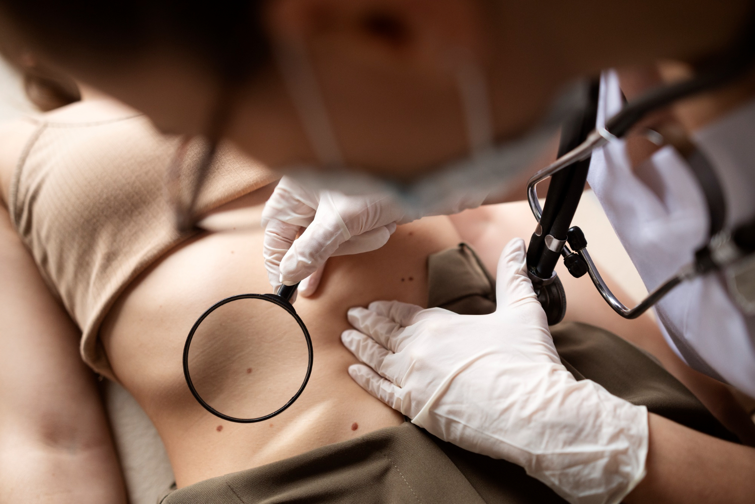 How Do We Deal With Unwanted Moles And Skin Tags?