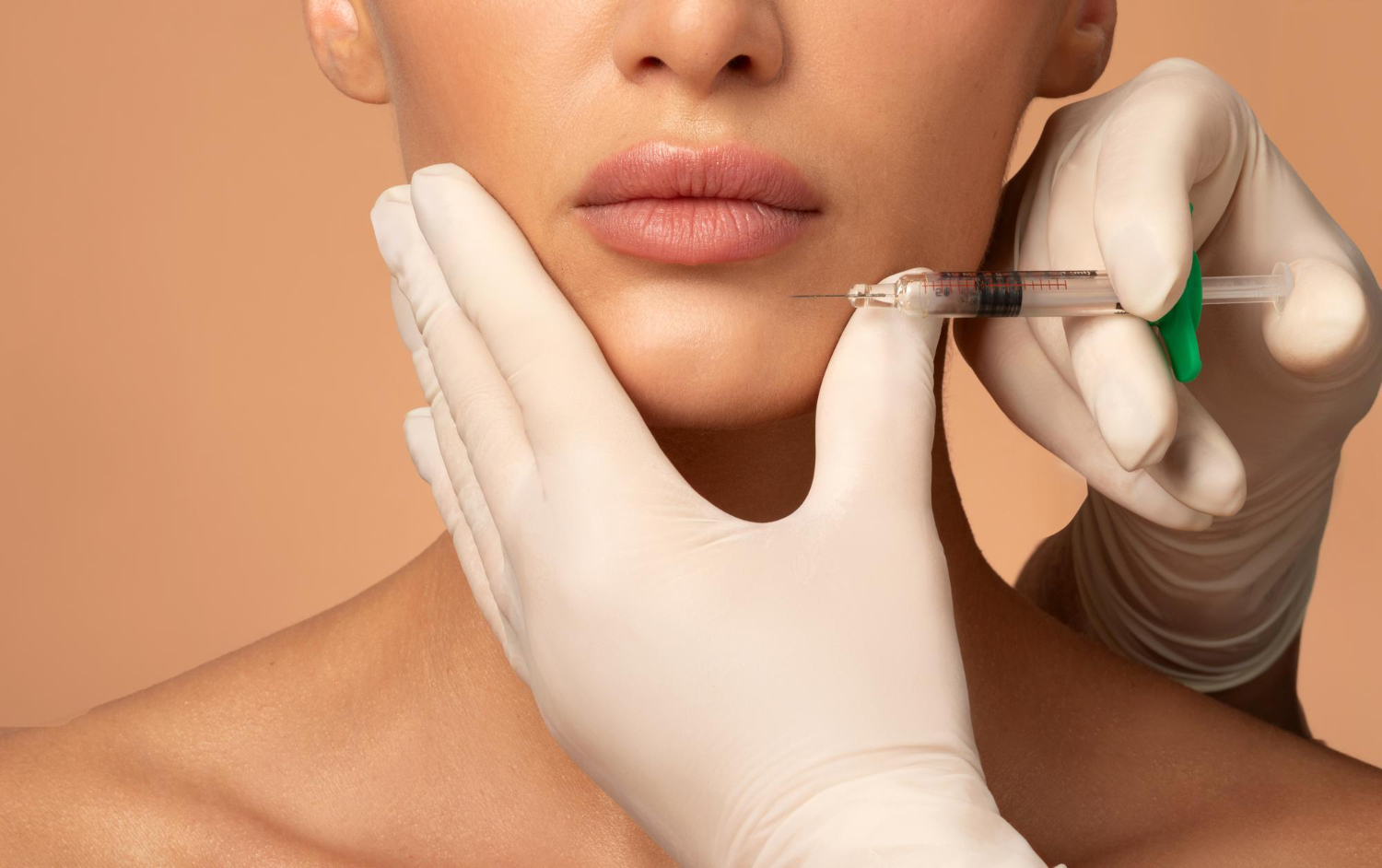 Radiesse Filler: How It Works, Results, Longevity And When to Choose It